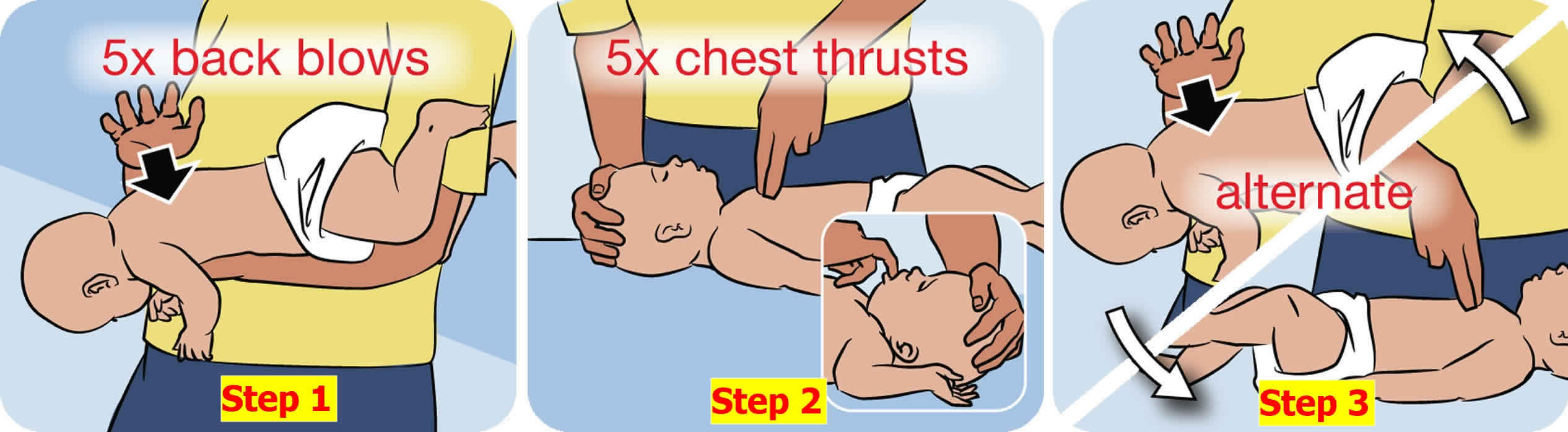 Heimlich-maneuver-baby-or-infant-under-one.jpg