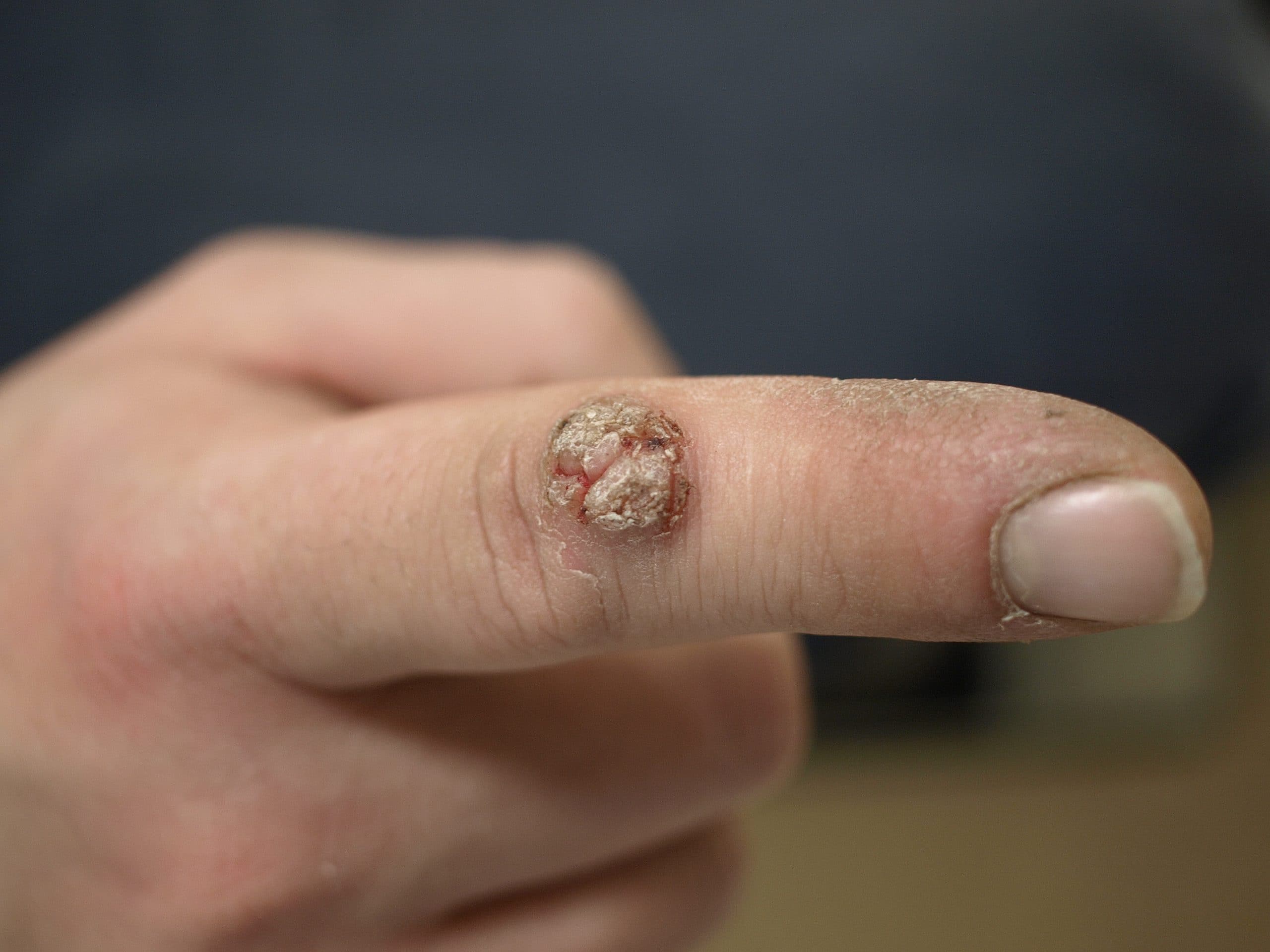 Gewone-wrat-op-een-vinger-scaled.jpg